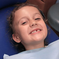 Ola (6 lat) po usunięciu zęba